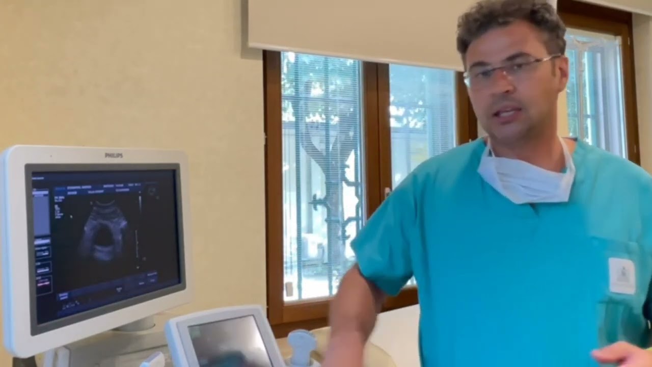 Sono stato trattato con il Rezum e ora?