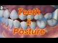 How teeth dictate posture | Teeth and Posture - Dr. Sanghmitra Dasgupta