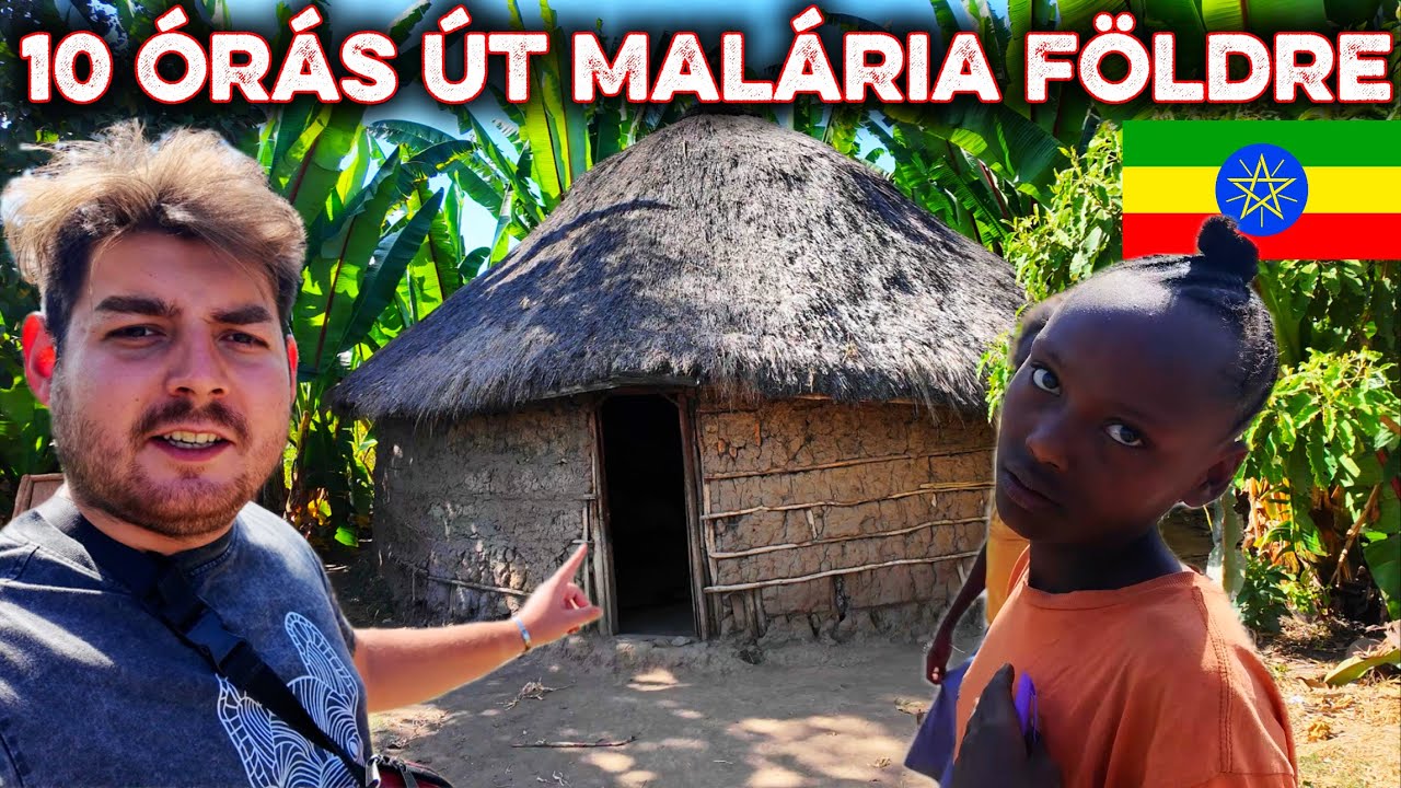 EZ TÉNYLEG A 21. SZÁZAD? ETIÓPIA SOKKOLÓ VALÓSÁGA 🇪🇹