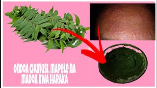 Jinsi Ya Kuondoa Madoa Chunusi Mapele Na Matatizo Ya Ngozi