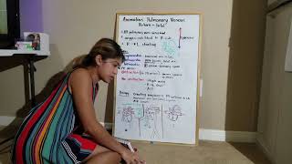 #5 Anomalous pulmonary venous return - total #studywithme