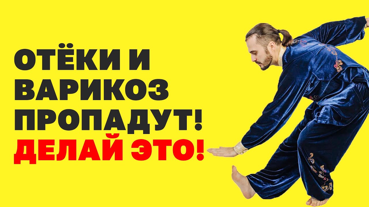 Как избавиться от отеков ног и варикоза? Упражнения от варикоза ...