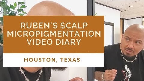Scalp Micropigmentation Before and After in Houston, Texas
