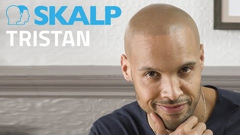 Beat baldness with scalp micro pigmentation. Watch Tristan