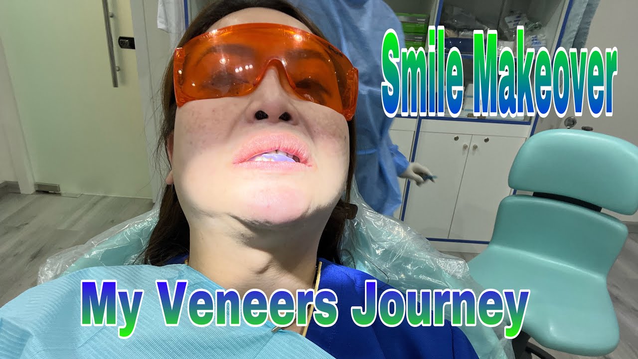 My Veneers Journey EMax Veneers YouTube