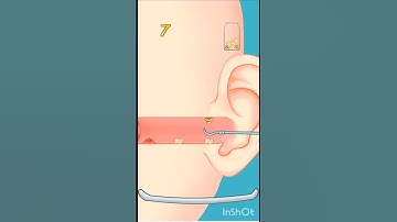 asmr stesfying ear doctor game play #games #asmrgames