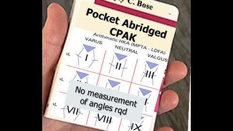 The Pocket abridged CPAK -  Part 1 of Simplifying & Unifying alignment concepts in TKR