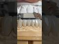 Monet Pure Zirconia crowns that we just completed in my lab for Dr. Marlina Pratt in Oklahoma