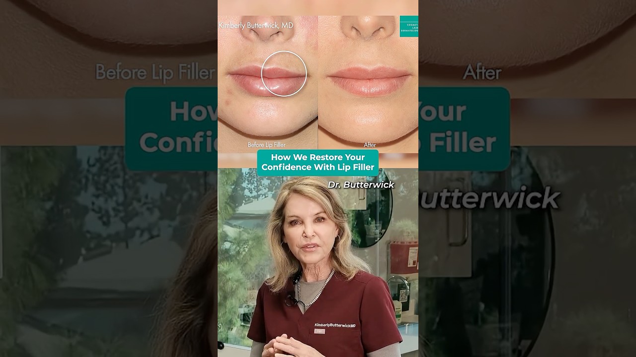 Banner for Fixing Bad Lip Filler: How We Correct Unnatural Results