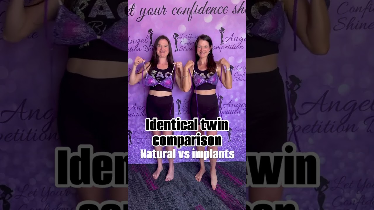 Idential Twin Implants vs  Natural comparison