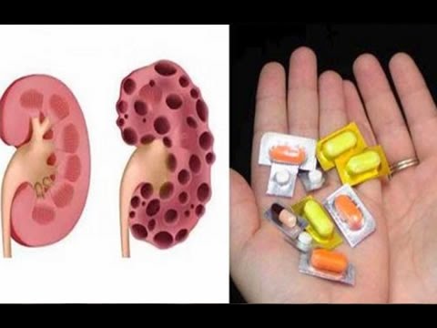 These Are The 10 Pills That Kill Your Kidneys And You Do not Tell You | Better health