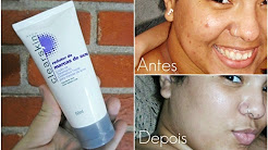 Resenha/ Redutor de Marcas de Acne - Avon Clearskin