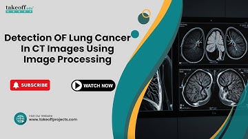 Detection OF Lung Cancer In CT Images Using Image Processing