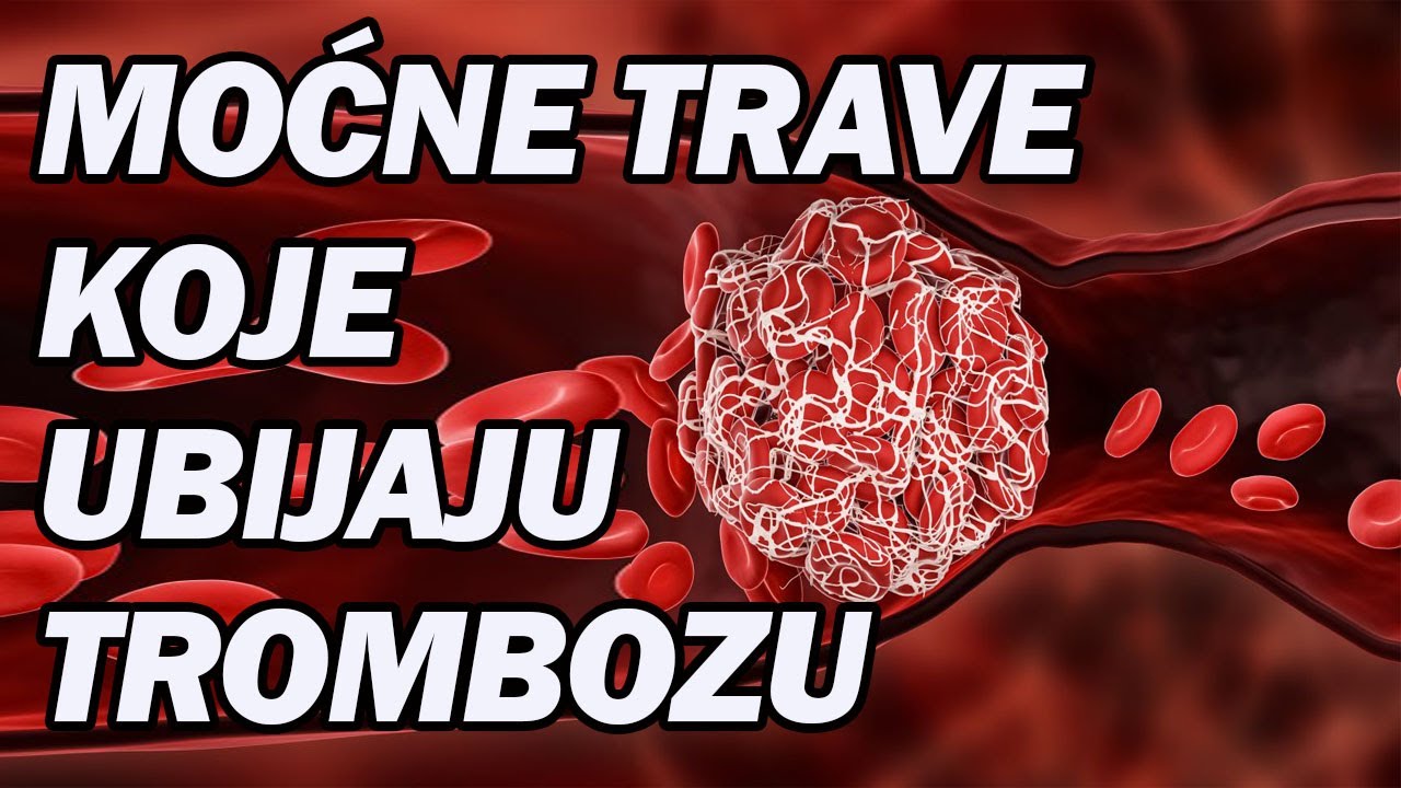 PERFEKTNE BILJKE JAČAJU KRV I ZAUSTAVLJAJU TROMBOZU! Dr Mihajlović