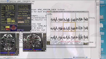 Intro to Resting State Connectivity Analysis: Part 2