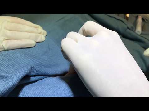 Vasectomy - No Needle, No Scalpel, in under 10 minutes