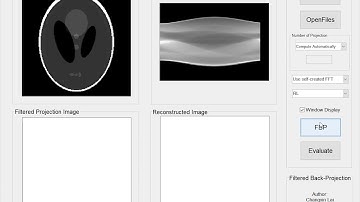 Filtered Back Projection