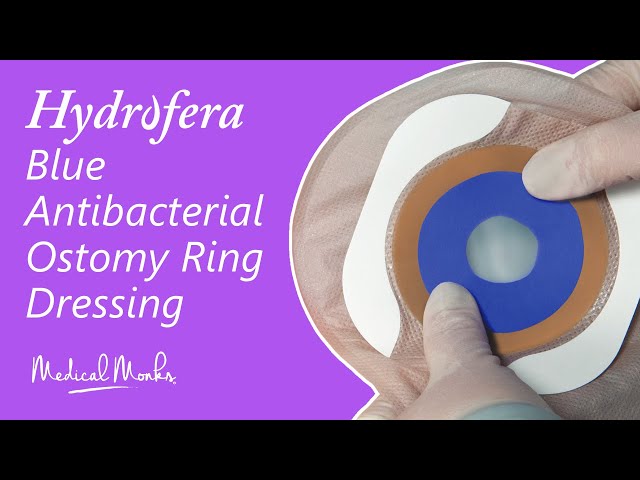 Product Demo: Hydrofera Blue Antibacterial Ostomy Ring Dressing | Medical  Monks - YouTube