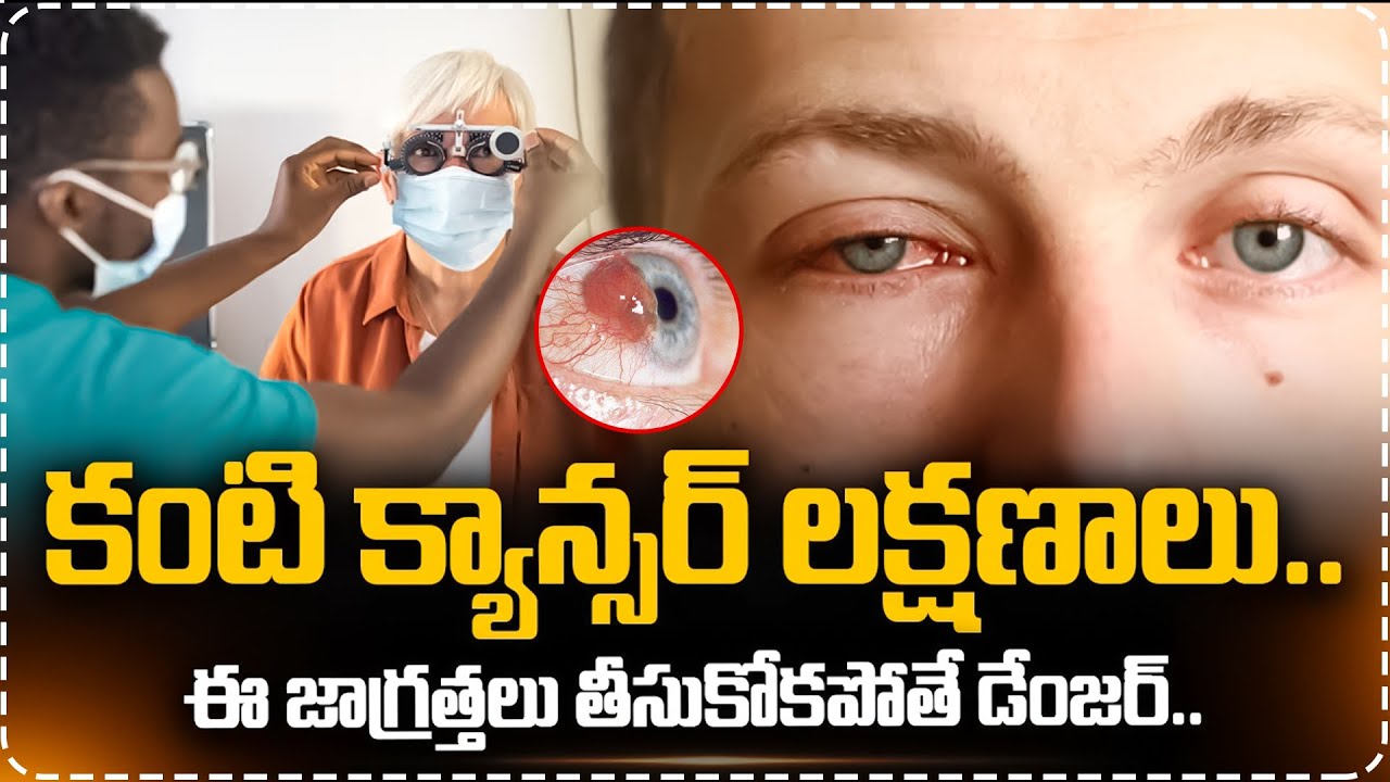 కంటి క్యాన్సర్ లక్షణాలు ఈ జాగ్రత్తలు తీసుకోకపోతే డేంజర్.. | Eye Cancer Signs & Symptoms | Eye Cancer