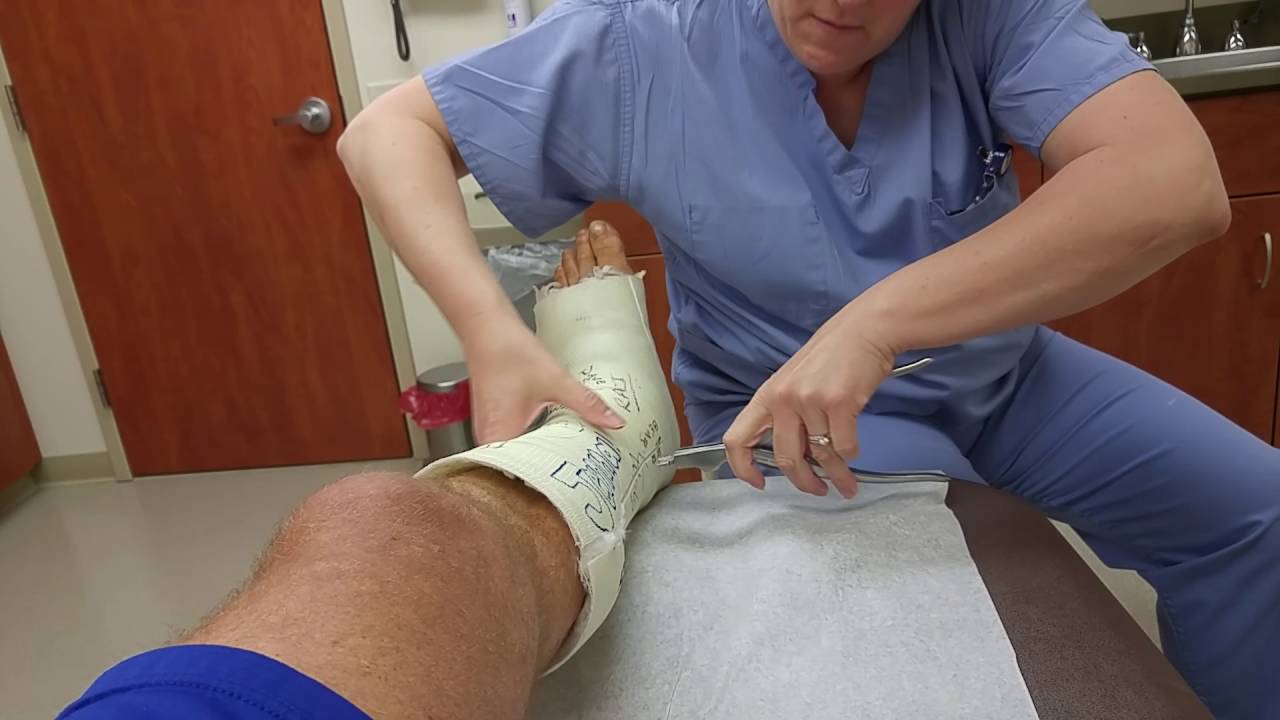 Cast Removal YouTube