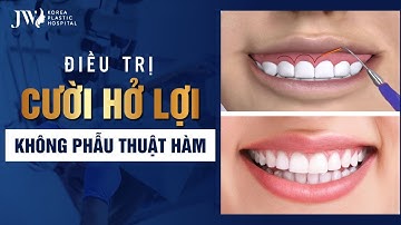 ĐIỀU TRỊ CƯỜI HỞ LỢI CHỈ 1 LẦN DUY NHẤT, KHÔNG PHẪU THUẬT HÀM