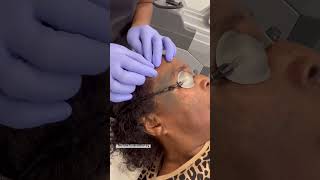 Have You Heard Of A Nevus Of Ota