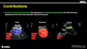 [MICCAI 2021] Oral: AutoFB - Automating Fetal Biometry Estimation from Standard Ultrasound Planes