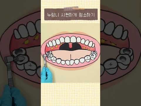 <strong>누렁니</strong> 시원하게 청소하기 #shorts
