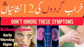 12 Warning ⚠️ Signs Your Kidneys Are Failing - Don&#39;t Ignore These Symptoms