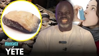 Ndiariniou Yéte (Bienfaits Du Yette) - Pr Ousmane Ndiaye - Sama Xalaa Tv