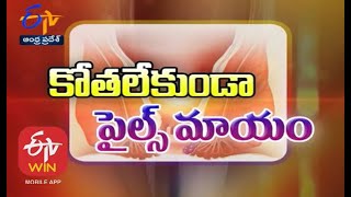 Non Invasive Treatments For Piles | Sukhibhava | 20th November 2020 | Full Episode | ETV AP