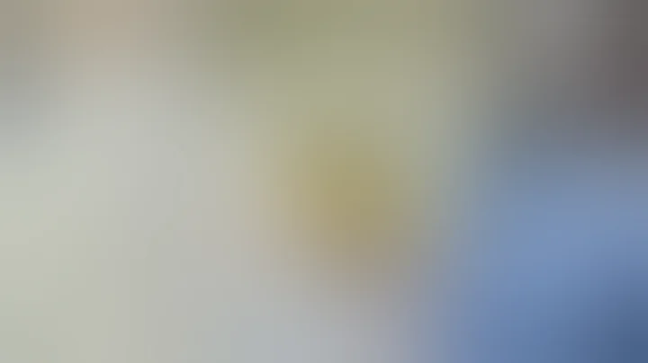 Distal Locking of a Femoral Nail: The "Perfect Circles" Technique