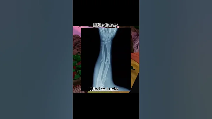 Worst gorilla tag injuries 😔#fypシ #gorillatagfun #jmancurly #