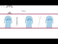 SmartGown™ EDGE Breathable Surgical Gown with ASSIST™ Instrument Pockets