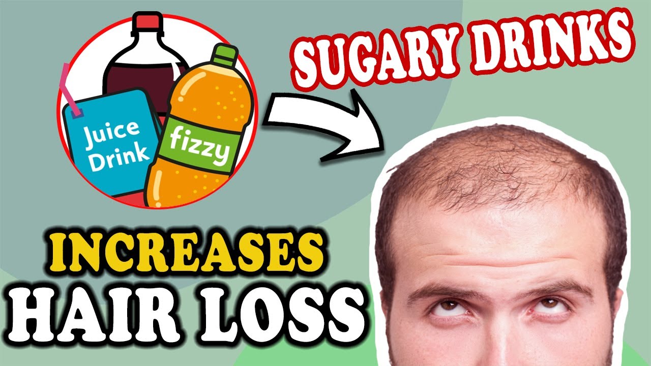 How Sugary Drinks May Influence Hair Loss YouTube