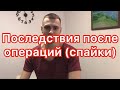 Как убрать спайки?