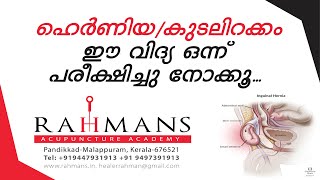 Hernia Acupuncture Reflexology Treatment Healer Rahman