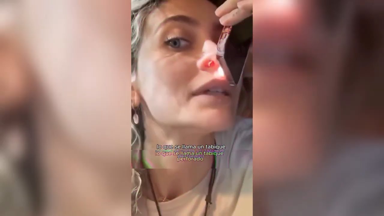 Hija de Michael Jackson con Huecos en la Nariz por exceso de Estup3f4cient3s