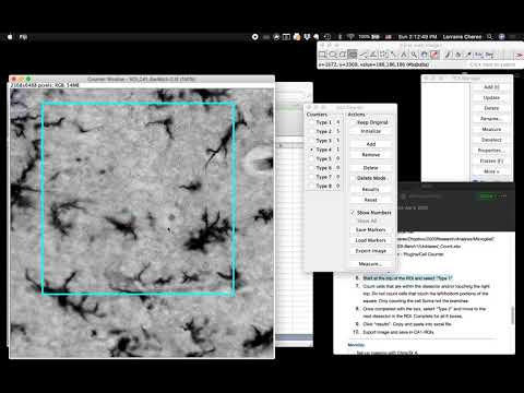 ImageJ Protocols: LS