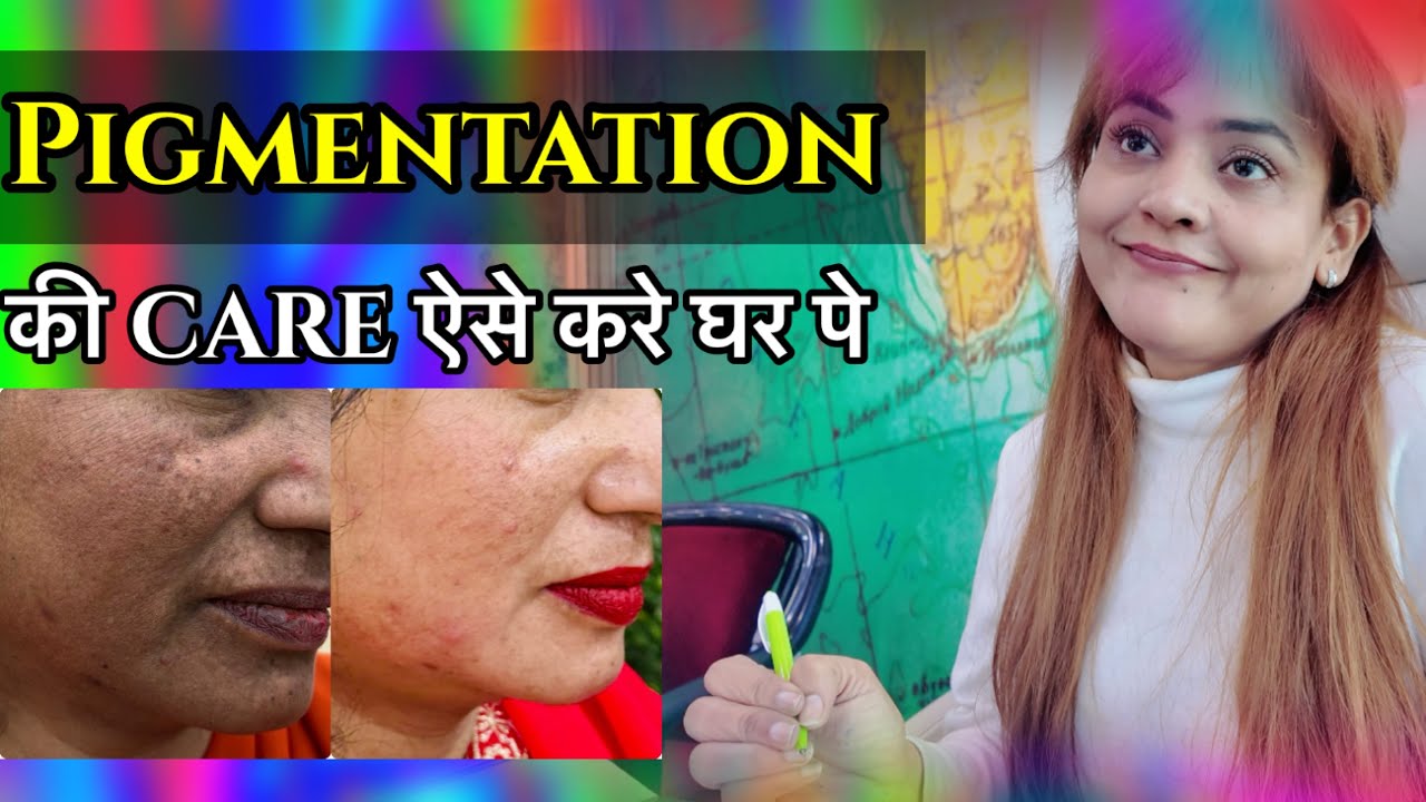 Chemical Damage |how to treat pigmentation at home | pigmentation solution ||khailyat – Nisha Lambha