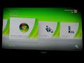 XBox 360 Media Center Extender in action