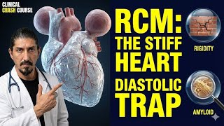 Restrictive Cardiomyopathy (RCM): Causes & Pathophysiology