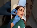 Sidra niazi ne krwaye botox sidra niazi having her botox done