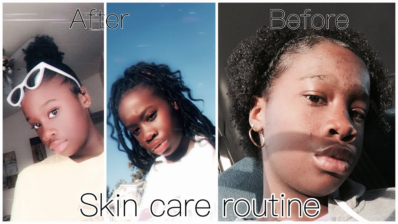 How I CLEARED my skin in 1 month • Skin Care Routine 2018 • - YouTube