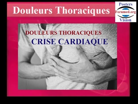 Vidéo: Douleurs Thoraciques Et Abdominales: 10 Causes, Symptômes Et Plus