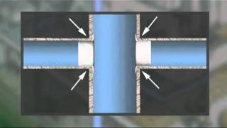 Oliner System, Indoor Rehabilitation, Long Version