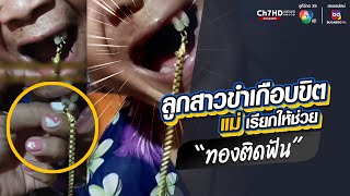 ลูกสาวขำเกือบขิต แม่เรียกให้ช่วย ตะขอสร้อยทองติดฟัน | ข่าวออนไลน์ 7HD