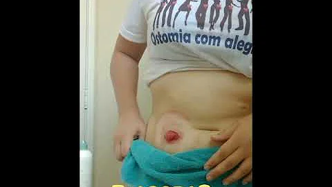 Como usar a bolsa de urostomia?