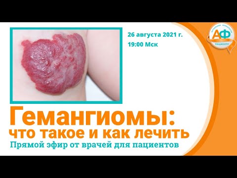 Видео: Являются ли гемангиомы заболеванием?