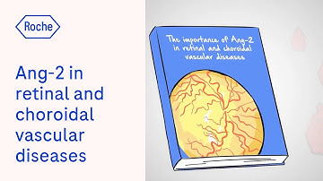 The importance of Ang-2 in retinal and choroidal vascular diseases